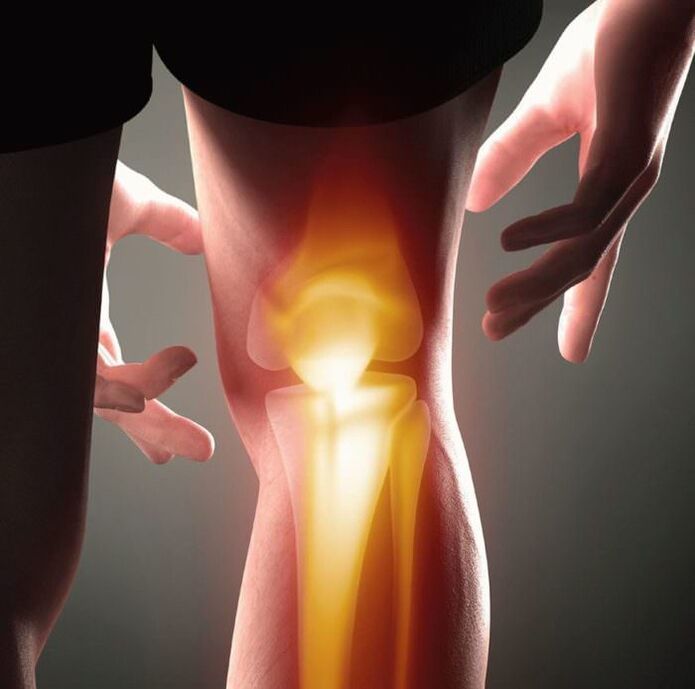 Kaj je artritis in arthroza